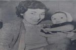 ماجرای نوزادی که نیمی از بدنش شبیه به میمون بود
