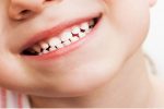 سن طلایی مراجعه به دندانپزشکی اطفال چه زمانی است؟