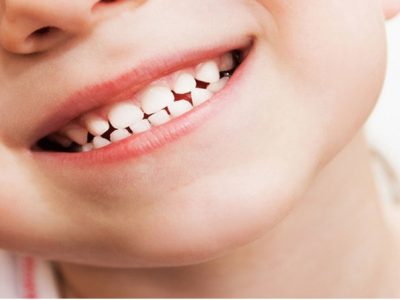 سن طلایی مراجعه به دندانپزشکی اطفال چه زمانی است؟