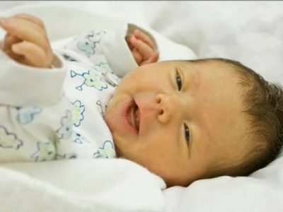 عوارض دائمی و خطرناک بی توجهی به زردی نوزادان