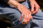 پوکی استخوان چیست و چگونه از آن پیشگیری کنیم