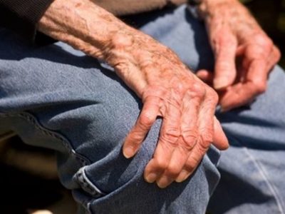 پوکی استخوان چیست و چگونه از آن پیشگیری کنیم