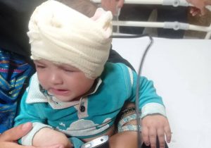 خارج کردن میله فلزی از سر نوزاد هشت ماهه در کازرون