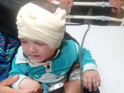 خارج کردن میله فلزی از سر نوزاد هشت ماهه در کازرون