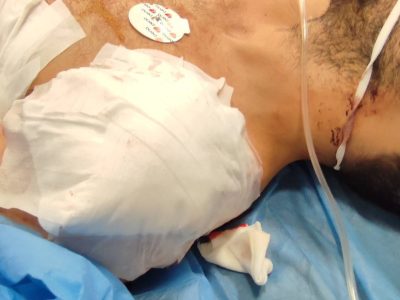 حمله با چاقو به دو کارشناس اورژانس ۱۱۵ حین انجام مأموریت